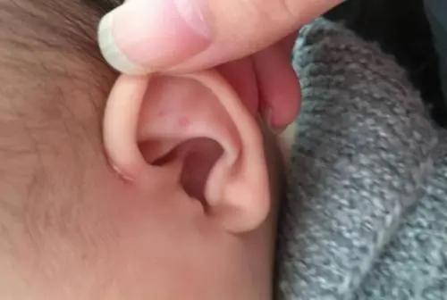 一岁前的婴儿总是挠耳朵。原因是什么，如何护理？妈妈应该知道她想要什么。 第6张